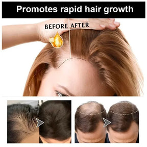 Hair growth oil