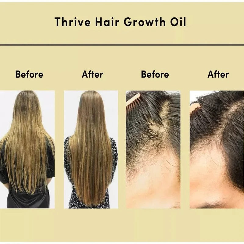 Hair growth oil